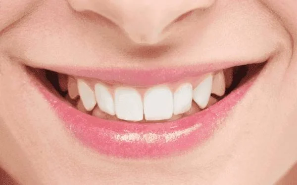How to Choose the Best Dental Clinic in Tirupur