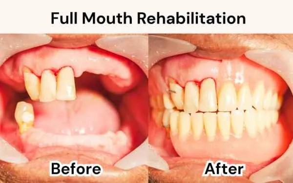 Surgical Dentistry