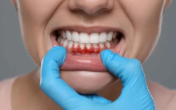 Bleeding Gums? 5 Gum Disease Symptoms You Can't Ignore